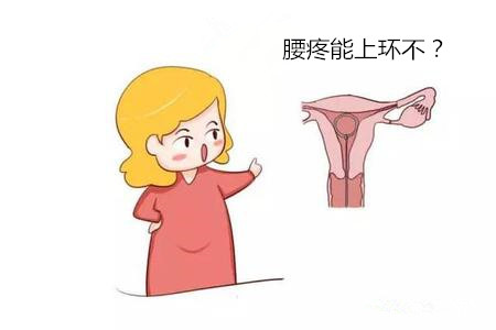 【腰疼能上环不】这8种情况不适合上环!