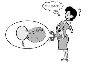 【提问】带环怀孕孩子能要吗?医生建议要从这2点考虑..
